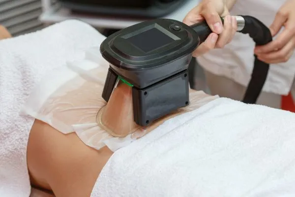 Image of person having fat freezing treatment to help weight gain Coombe