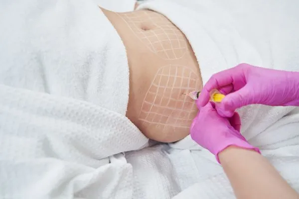 image of fat dissolving injections on love handles to help combat weight gain Coombe