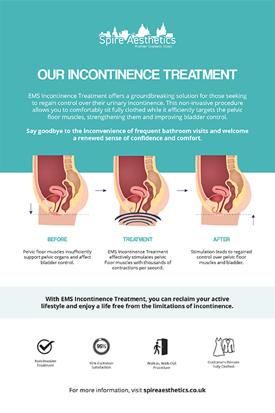 image of how urge incontinence Coombe treatment works